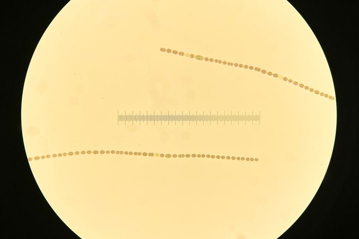 Mikroskooppikuva  Dolichospermum -suvun sinilevästä.