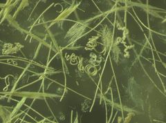 Olika cyanobakterier i mikroskopbilden. Några av dem är spiralformade, några är hårliknande.