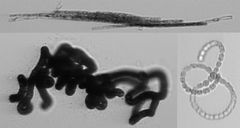 Kasviplanktonin automaattiseen kuvantamiseen suunnitellun laitteen tuottamia kuvia eri sinilevälajeista Utön merentutkimusasemalla otetuista vesinäytteistä. Kuvassa ylhäällä Aphanizomenon flos-aquæ, alhaalla vasemmalla Nodularia spumigena ja alhaalla oikealla Dolichospermum sp.